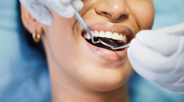Best Emergency Denture Repair in Woodbridge, CA