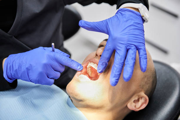 Best Urgent Care for Lost Fillings or Crowns in Woodbridge, CA